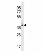 PGA4 antibody western blot analysis in WiDr lysate.