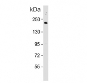 Western blot testing of human HepG2 cell lysate with C4B antibody. Predicted molecular weight ~193 kDa.