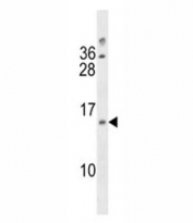 DUSP13 antibody western blot analysis in A2058 lysate
