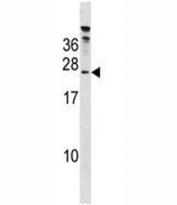 HTATSF1 antibody western blot analysis in 293 lysate.