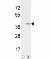 Western blot analysis of CCND1 antibody ans 293 cell lysate (2 ug/lane) either nontransfected (Lane 1) or transiently transfected with the CCND1 gene (2). Predicted molecular weight: 32-36 kDa.