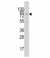 Western blot analysis of GCN5 antibody and 293 lysate. Expected molecular weight ~94 kDa.