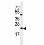 Bax antibody western blot analysis in HL-60 lysate