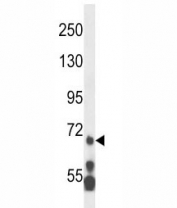 MLL5 antibody western blot analysis in HL-60 lysate.