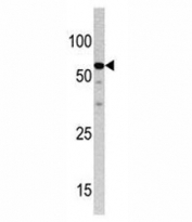 Western blot analysis of NCAPH2 antibody and HepG2 lysate.