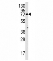 Western blot analysis of Rex1 antibody and mouse lung tissue lysate