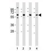 Western blot testing of Pyruvate Kinase antibody at 1:2000 dilution. Lane 1: MCF-7 lysate; 2: HeLa; 3: NIH3T3; 4: PC-12; Predicted molecular weight ~ 58 kDa.