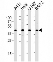 Western blot analysis of lysate from A431, HeLa, U-937, BA/F3 cell lines using PGK1 diluted at 1:1000 for each lane. Expected/observed molecular weight ~44kDa.