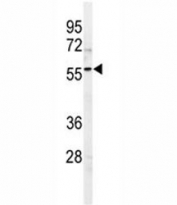 Western blot analysis of SPHK1 antibody and 293 lysate. Predicted molecular weight: ~43/51/44kDa (isoforms 1/2/3).