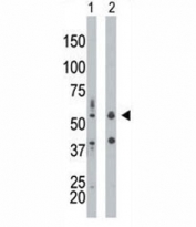 PKR antibody used in western blot to detect PRKR/PKR in mouse liver tissue lysate (Lane 1) and HepG2 cell lysate (2). Predicted molecular weight ~62 kDa but routinely observed at 68-72 kDa.