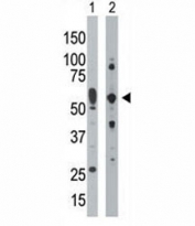 PRKR antibody used in western blot to detect PRKR/PKR in mouse uterus tissue lysate (Lane 1) and HepG2 cell lysate (2). Predicted molecular weight ~62 kDa but routinely observed at 68-72 kDa.