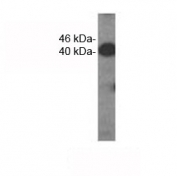 Western analysis of extracts from HDMEC cells using VEGFC antibody. Predicted molecular weight ~46 kDa.