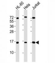 Western blot testing of SUMO1 antibody at 1:4000 dilution. Lane 1: HL-60 lysate; 2: HeLa lysate; 3: Jurkat lysate. Predicted molecular weight: 12-15 kDa