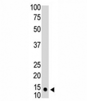 The SUMO1 antibody used in western blot to detect SUMO1 in HL-60 cell lysate. Predicted molecular weight: 12-15 kDa