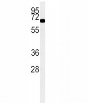 ACOX1 antibody western blot analysis in K562 lysate (15ug/lane). Predicted molecular weight ~74 kDa.