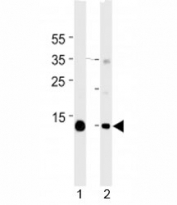 Myoglobin antibody western blot analysis in mouse 1) heart and 2) skeletal muscle tissue lysate. Predicted molecular weight ~17 kDa.