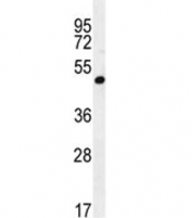 A4GALT antibody western blot analysis in 293 lysate. Predicted molecular weight ~40 kDa.