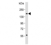 Western blot testing of human spleen lysate with CD11b antibody. Expected molecular weight: 128-170 kDa depending on glycosylation level.