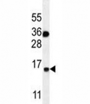 S100A1 antibody western blot analysis in MDA-MB435 lysate. Predicted molecular weight: 12-15 kDa.