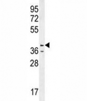 Caspase-12 antibody western blot analysis in HL-60 lysate. Predicted molecular weight ~50/36~42kDa (pro/active)