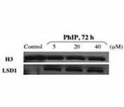Western blot testing of LSD1 antibody and nuclear extracts of control and PhIP-treated HMEC cells. Nuclear LSD1 protein levels increased in carcinogen-treated HMEC compared with control HMEC.