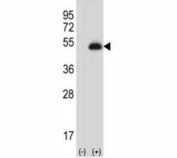 Western blot analysis of anti-PAX6 antibody and 293 cell lysate (2 ug/lane) either nontransfected (Lane 1) or transiently transfected (2) with the PAX6 gene. Predicted molecular weight ~48kDa.
