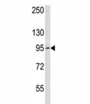 BCL6 antibody western blot analysis in HeLa lysate. Predicted molecular weight: 78~100 kDa.