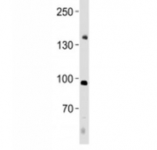 NFATC4 antibody western blot analysis in human placenta tissue lysate. Predicted molecular weight ~95 kDa, also can be observed at 120-140 kDa.