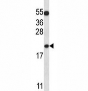 BAX antibody western blot analysis in K562 lysate