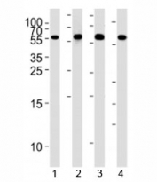 Western blot analysis of lysate from 1) HepG2, 2) NCI-H460,3) Raji, and 4) Ramos cell line using MMP3 antibody at 1:1000. Predicted molecular weight ~54kDa.