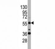 Western blot analysis of SOX9 antibody and K562 lysate. Predicted molecular weight: 56-65 kDa.