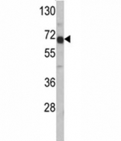 Western blot analysis of AFP antibody and HepG2 lysate. Predicted molecular weight: ~70kDa.