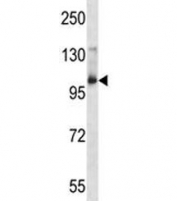 Aak1 antibody western blot analysis in mouse bladder tissue lysate. Predicted molecular weight: ~104kDa.