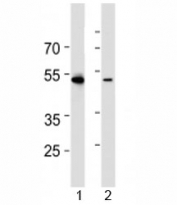 Western blot analysis of lysate from 1) HL-60 and 2) Jurkat cell line using RUNX3 antibody at 1:1000. Predicted molecular weight: ~44 kDa, isoforms can be observed at 42-48 kDa.