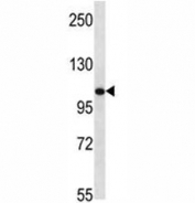 TLR8 antibody western blot analysis in mouse bladder tissue lysate. Expected molecular weight ~120 kDa.