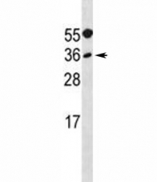MYF5 antibody western blot analysis in A549 lysate. Predicted molecular weight ~28kDa.