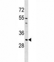 AQP1 antibody western blot analysis in A549 lysate. Predicted molecular weight ~28kDa.