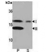 Western blot analysis of LC3 antibody and rat brain lysate: Both lipidated (arrow, II) and non-lipidated (arrow, I) were detected in membrane fraction (P) but only non-lipidated LC3 was detected in soluble fraction (S).