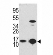 Western blot analysis of MAP1LC3B antibody and Y79 lysate and mouse brain tissue lysate