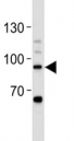 STAT-3 antibody western blot analysis in Daudi lysate. Predicted/observed molecular weight ~88kDa.