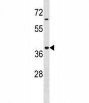Hoxa9 antibody western blot analysis in MDA-MB453 lysate. Expected/observed molecular weight: ~30kDa.