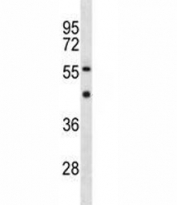 YY1 antibody western blot analysis in MDA-MB453 lysate. Observed molecular weight: 68/40 kDa.