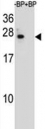 BCL-2 antibody pre-incubated without (Lane 1) and with (2) blocking peptide in 293 lysate