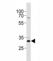 CCND1 antibody western blot analysis in HeLa lysate. Predicted molecular weight: 32-36 kDa.