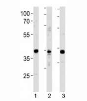 NeuroD1 antibody western blot analysis in 1) Y79 cell line, 2) mouse cerebellum and 3) rat brain tissue lysate.