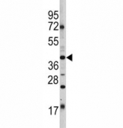 Western blot analysis of Oct-4 antibody and HL-60 lysate. Predicted molecular weight ~38/30kDa (isoform A/B), commonly observed at 38-45 kDa.