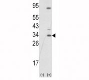 Western blot analysis of SNAI1 antibody and 293 cell lysate (2 ug/lane) either nontransfected (Lane 1) or transiently transfected with the SNAIL gene (2). Predicted molecular weigth ~29kDa.