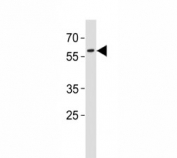 PAX3 antibody western blot analysis in A431 lysate. Predicted molecular weight: there are 7 isoforms ranging from 22~56kDa.