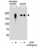 Western blot analysis of extracts from A431 cells, untreated or treated with EGF, using phospho-EGFR antibody (left) or nonphos Ab (right)