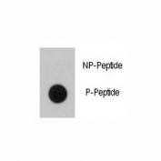 Dot blot analysis of phospho-BRAF antibody. 50ng of phos-peptide or nonphos-peptide per dot were spotted.
